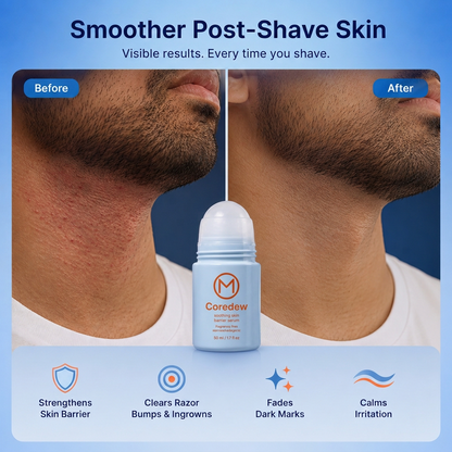 Coredew® Razor Bump & Skin Barrier Reset Roll-On