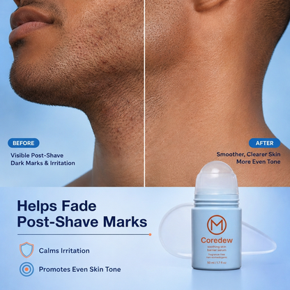 Coredew® Razor Bump & Skin Barrier Reset Roll-On